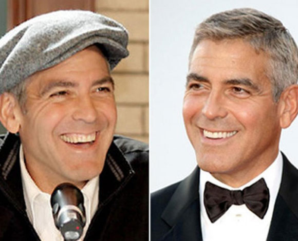 أبزر النجوم الذين خضعوا لعمليات تجميل في أسنانهم