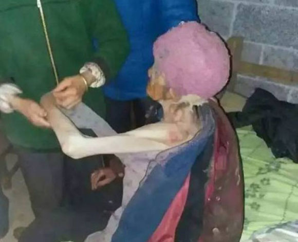 ابن وزوجته يحبسان والدته في قبو حتى تدهورت صحتها .. فيديو مزعج