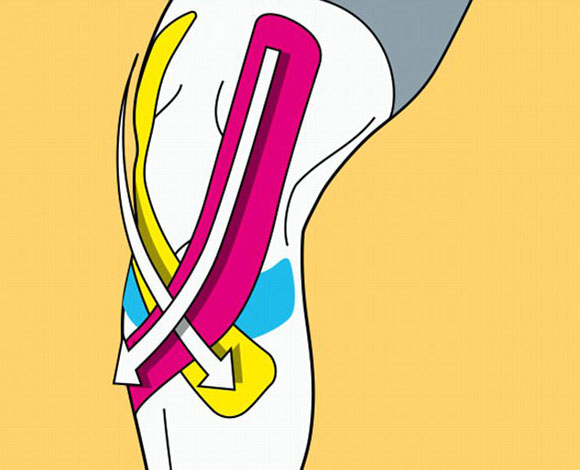 تعرف إلى أشرطة kinesiology اللاصقة التي تعالج الإصابات الرياضية