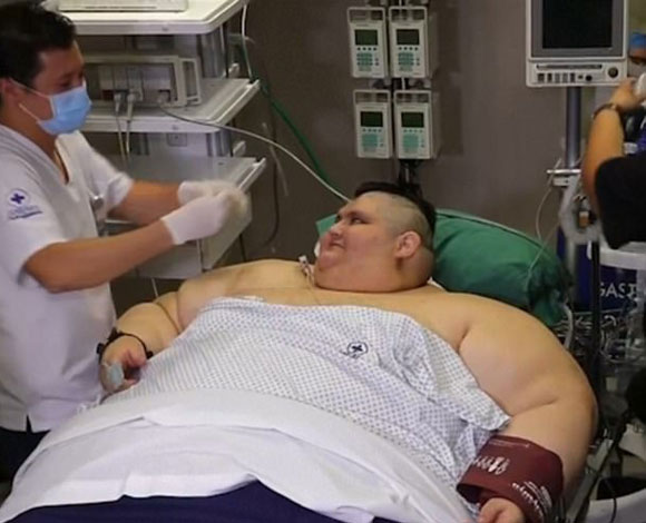 أسمن رجل في العالم يخضع لجراحة بالمعدة بعد أن فقد 385 رطلاً !