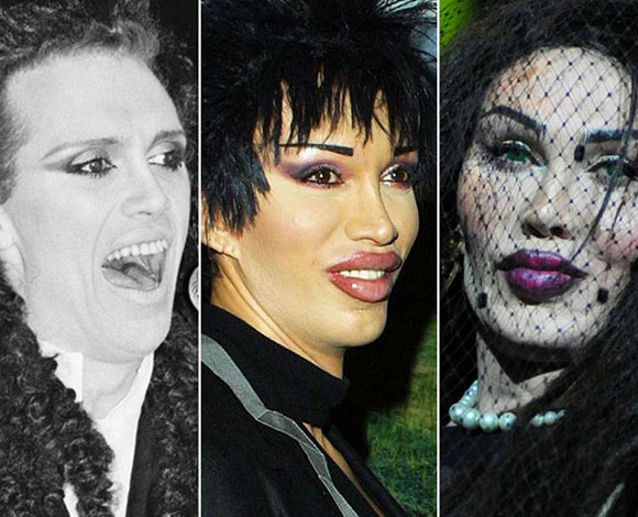 جراحات تجميل فاشلة راح ضحيتها 9 من النجوم والنجمات