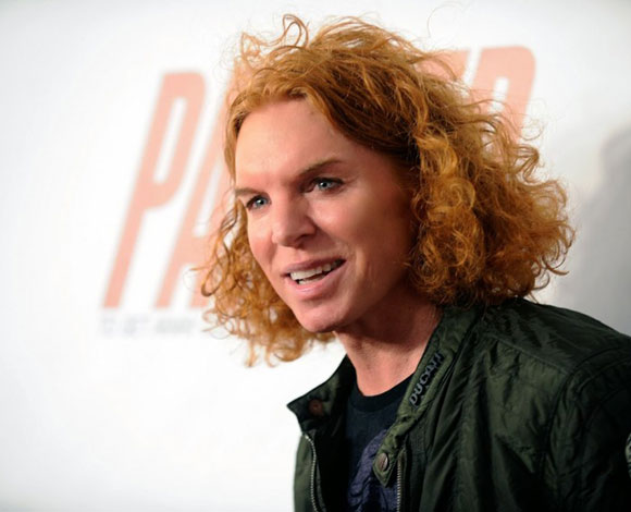 عندما تفشل عمليات تجميل النجوم... نتائج عكسية ستصدمك