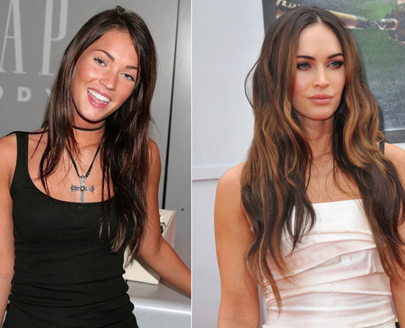 10 نجوم ونجمات باتوا أجمل مع جراحات التجميل... تعرف إليهم