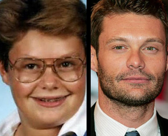 أبرز 10 نجوم تبدلت ملامحهم بشكل كبير عن مرحلة المراهقة