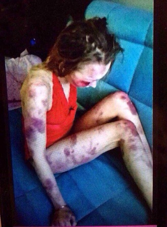يضرب زوجته ويرسل الصورة لأصدقائه