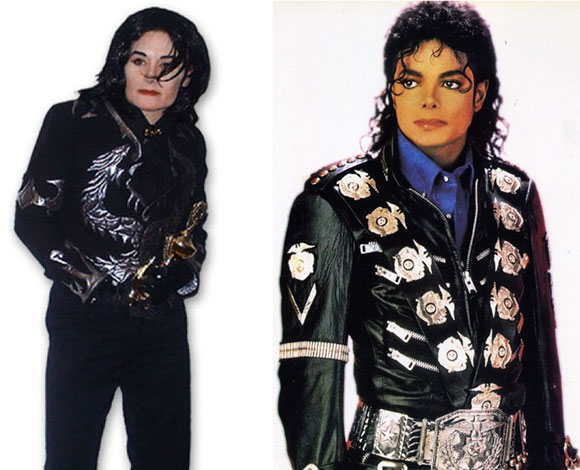 اشهر حالات عمليات التجميل الفاشلة للتشبه بالنجوم والنجمات