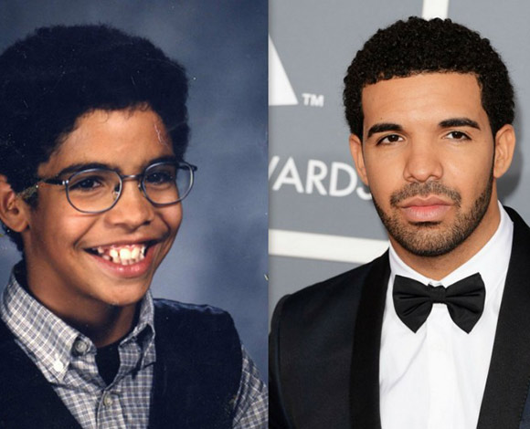 شاهد صور النجوم في بداياتهم... مصدر إحراجهم