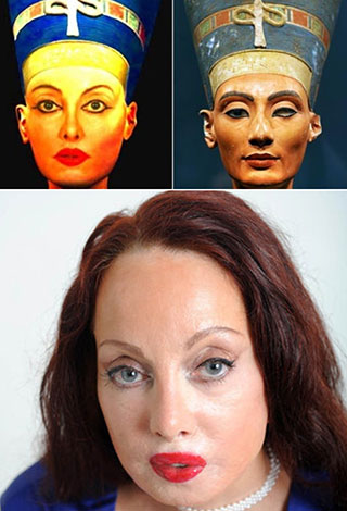 اشهر حالات عمليات التجميل الفاشلة للتشبه بالنجوم والنجمات