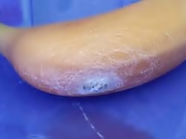 ما وجدته هذه السيدة في ثمار الموز مرعبًا