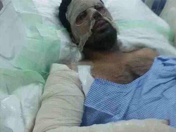 بالصور: جندي يروي قصة انفجار لغم بوجهه خلال إنقاذه لزميله
