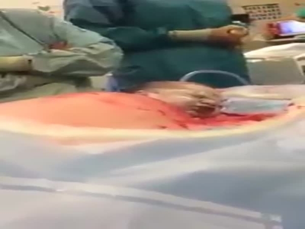 صممت أن تلد طفلها دون بنج كلي .. فشاهد ماذا حدث