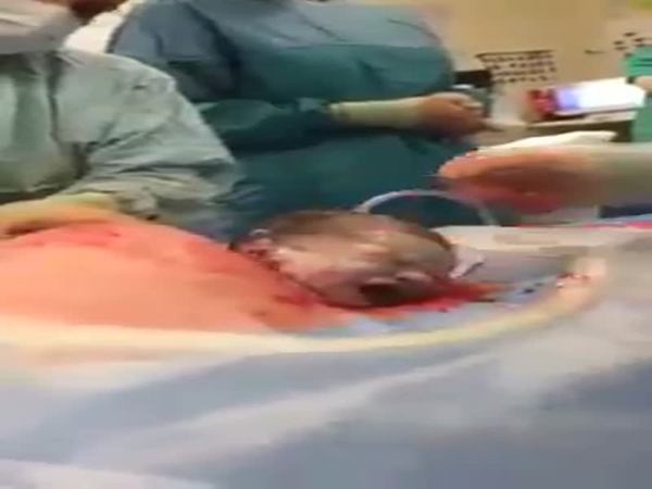 صممت أن تلد طفلها دون بنج كلي .. فشاهد ماذا حدث