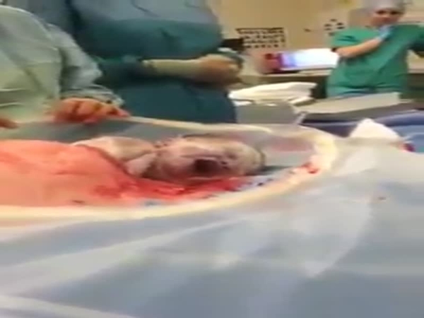 صممت أن تلد طفلها دون بنج كلي .. فشاهد ماذا حدث