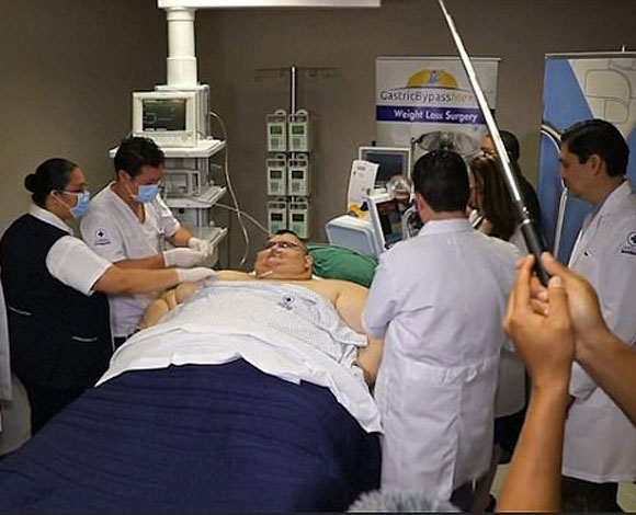 أسمن رجل في العالم يخضع لجراحة بالمعدة بعد أن فقد 385 رطلاً !