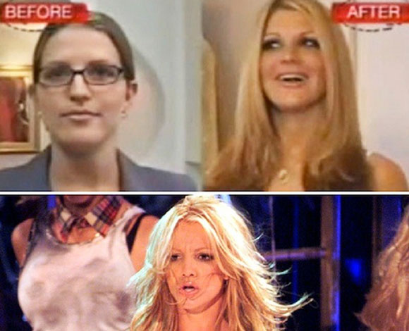 اشهر حالات عمليات التجميل الفاشلة للتشبه بالنجوم والنجمات