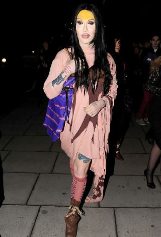 عندما تفشل عمليات تجميل النجوم... نتائج عكسية ستصدمك