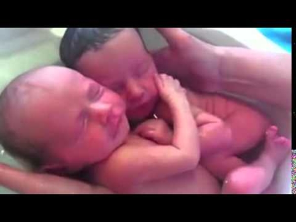 شاهد .. توأم لم يشعر بعد بخروجهم من بطن أمه