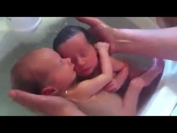 شاهد .. توأم لم يشعر بعد بخروجهم من بطن أمه