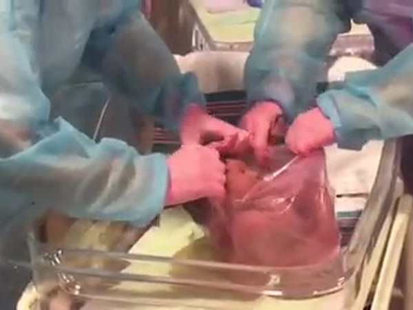 شاهد بالفيديو .. ولادة قيصرية لدمية مصنوعة يدويً
