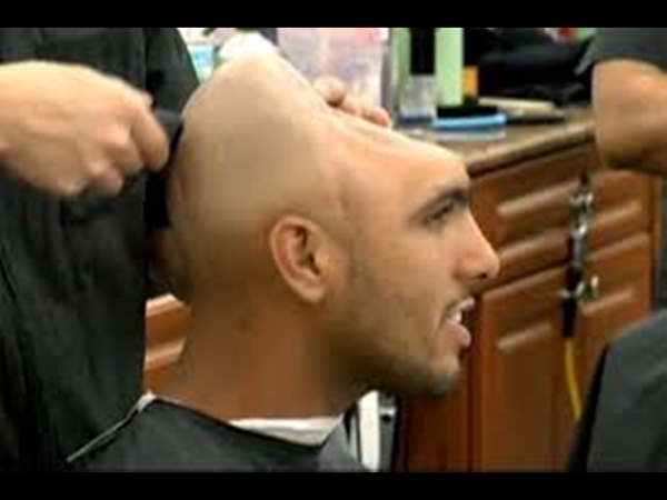 رجل بنصف رأس يحذر من المخدرات .. شاهد بالفيديو