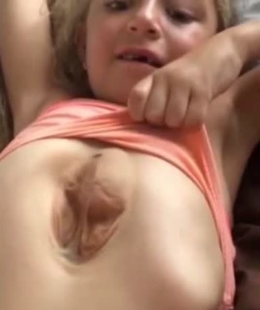 طفلة قلبها ينبض خارج صدرها .. فيديو