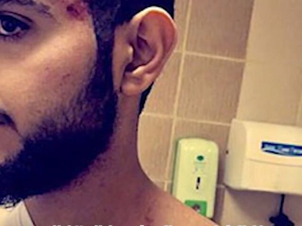 هجوم لبوء مفترسة على شاب بالباحة
