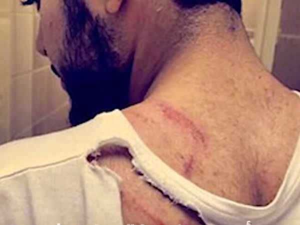 هجوم لبوء مفترسة على شاب بالباحة