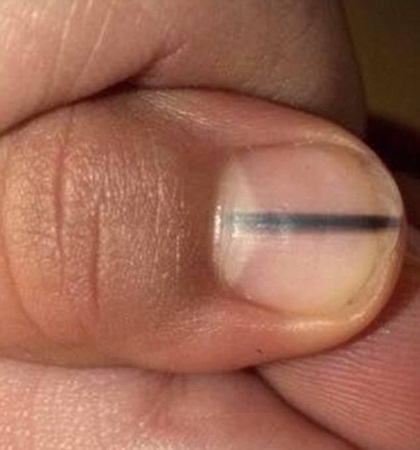 ذهبت لصالون التجميل .. فنصحوها بالذهاب إلى المستشفى