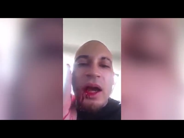يطلق النار على نفسه أمام عدسة الكاميرا .. والسبب أغرب من الخيال