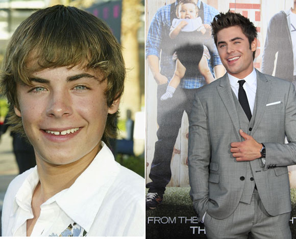 10 نجوم ونجمات باتوا أجمل مع جراحات التجميل... تعرف إليهم