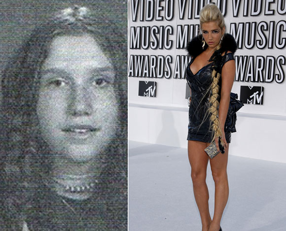 أبرز 10 نجوم تبدلت ملامحهم بشكل كبير عن مرحلة المراهقة