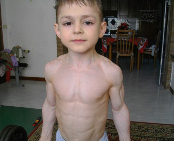 تعرف الى 11 إنساناً حقيقيا من أمثال X-Men