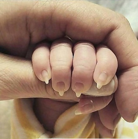 صورة كف رضيع تثير رواد مواقع التواصل الاجتماعي