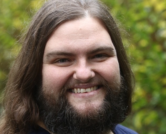 امرأة تدعي أنها تشعر بأنوثة عالية عندما لا تزيل الشعر الزائد في جسمها