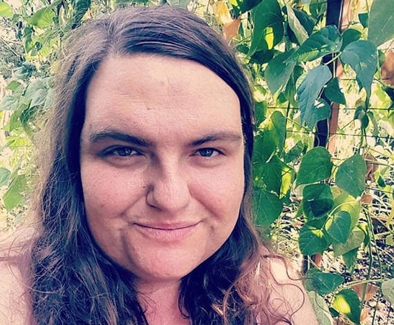 امرأة تدعي أنها تشعر بأنوثة عالية عندما لا تزيل الشعر الزائد في جسمها