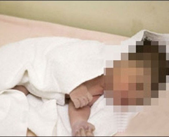 قد لا تصدق... طفل عربي بجسم سمكة