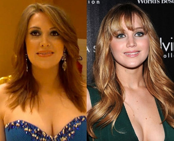 اشهر حالات عمليات التجميل الفاشلة للتشبه بالنجوم والنجمات