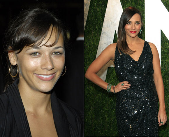 10 نجوم ونجمات باتوا أجمل مع جراحات التجميل... تعرف إليهم