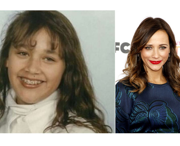 أبرز 10 نجوم تبدلت ملامحهم بشكل كبير عن مرحلة المراهقة