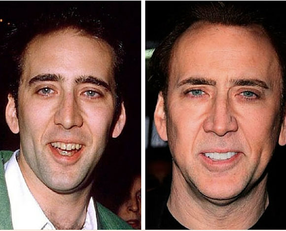 أبزر النجوم الذين خضعوا لعمليات تجميل في أسنانهم