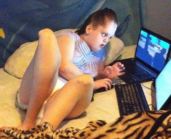 فتاة تعاني من نمو ساقيها وجمجمتها بصورة لا يمكن التحكم فيها!