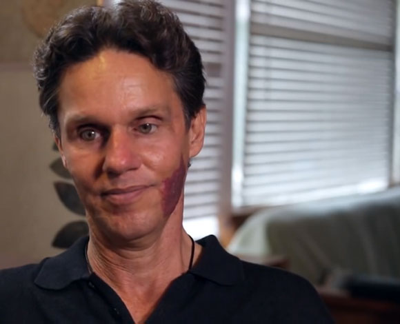 تعرف الى 11 إنساناً حقيقيا من أمثال X-Men