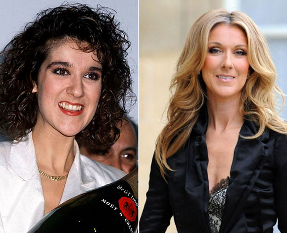 10 نجوم ونجمات باتوا أجمل مع جراحات التجميل... تعرف إليهم