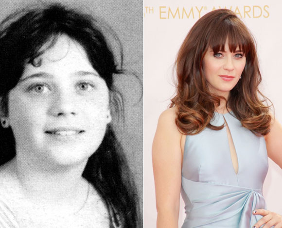 أبرز 10 نجوم تبدلت ملامحهم بشكل كبير عن مرحلة المراهقة