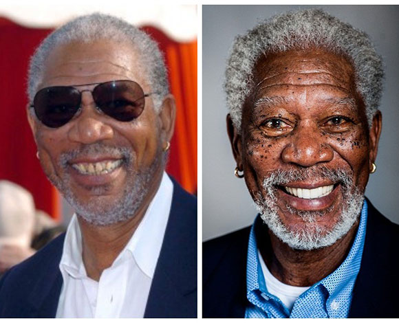 أبزر النجوم الذين خضعوا لعمليات تجميل في أسنانهم