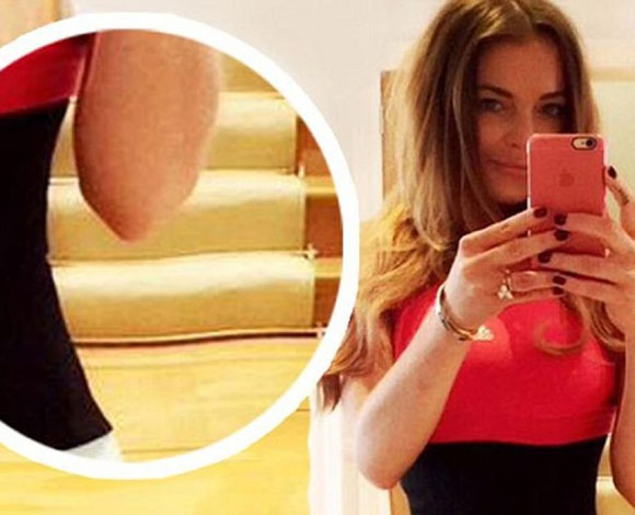 نجوم ونجمات أخفوا بعض العيوب في صور سيلفي لهم بالفوتوشوب