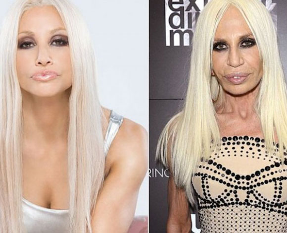 جراحات تجميل فاشلة راح ضحيتها 9 من النجوم والنجمات