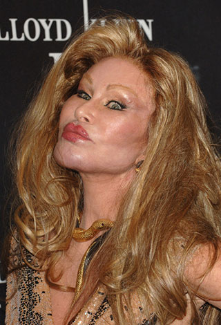 عندما تفشل عمليات تجميل النجوم... نتائج عكسية ستصدمك