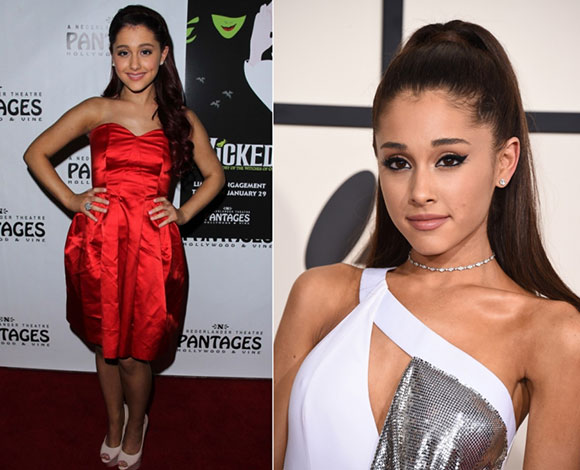 10 نجوم ونجمات باتوا أجمل مع جراحات التجميل... تعرف إليهم