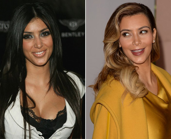 شاهد صور النجوم في بداياتهم... مصدر إحراجهم